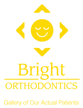 Bright Orthodontics logo