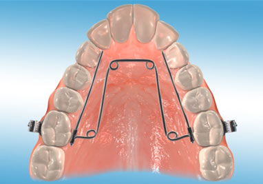 Quad Helix